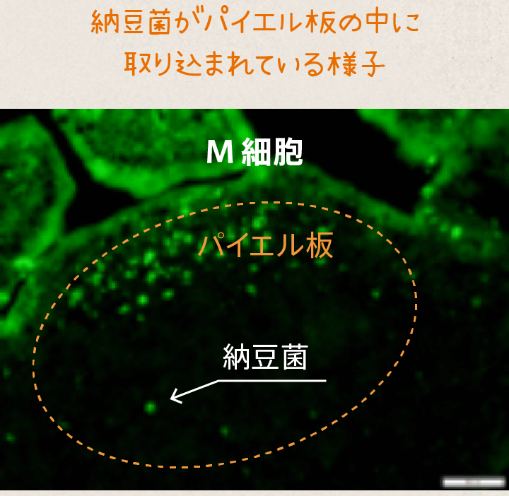 納豆菌がパイエル板の中に取り込まれている様子